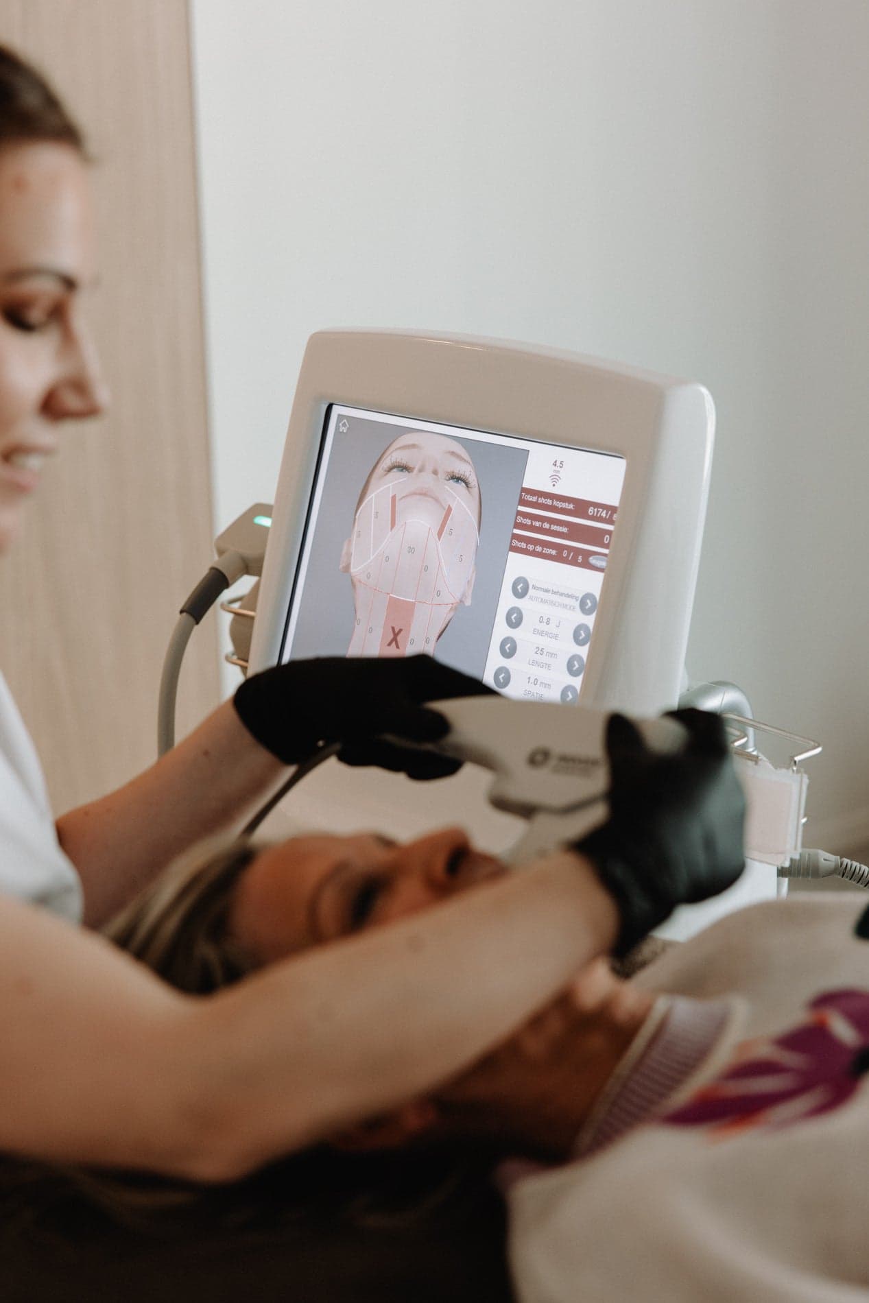 HIFU Treatment Areas