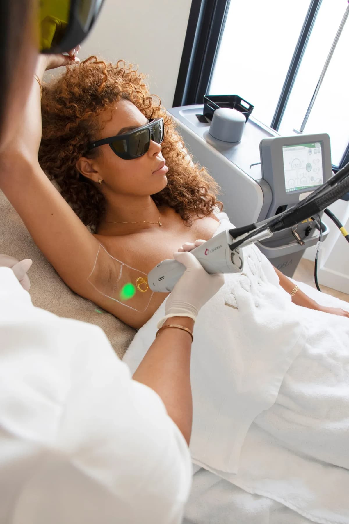 Laser hair removal for women
